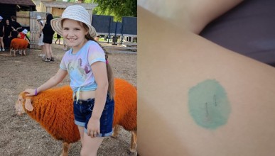 9-летняя актриса театра драмы стала жертвой нападения огромной крысы